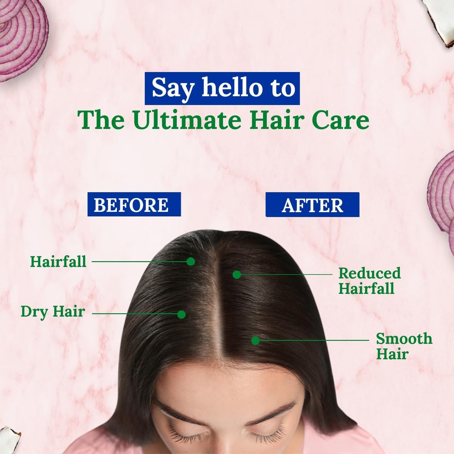 Parachute Advansed Onion Dandruff & Hair Fall Control Oil
