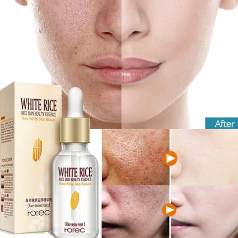 Rorec Rice Skin Beauty Serum Essence